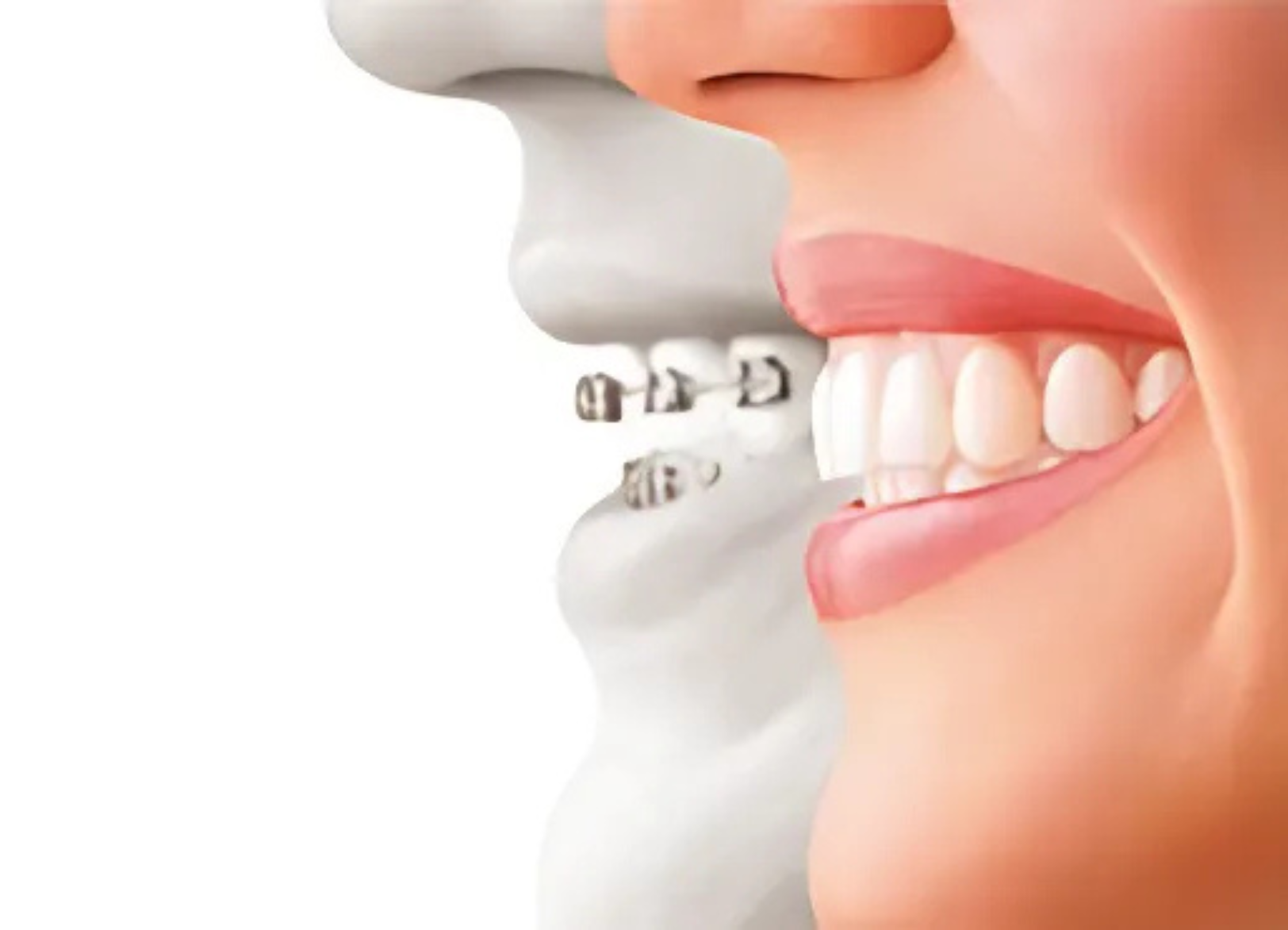 インビザライン対応可能|MAEDA DENTAL