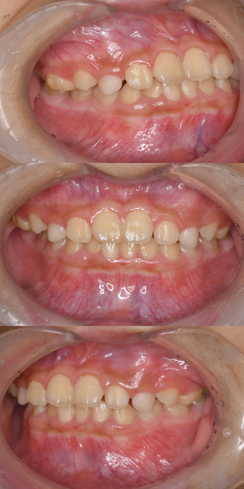 case_ortho-02a