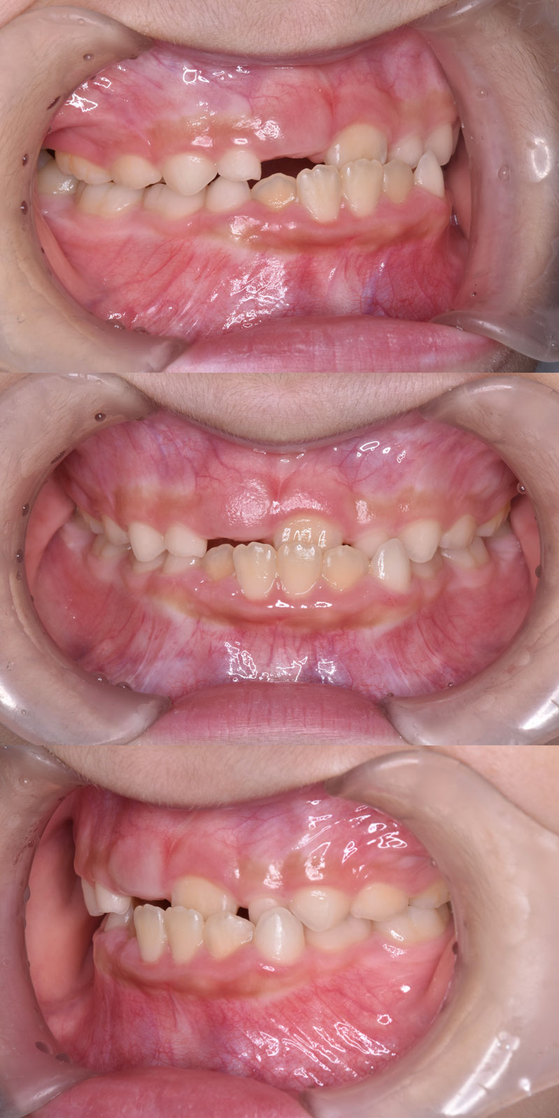 case_ortho-02b