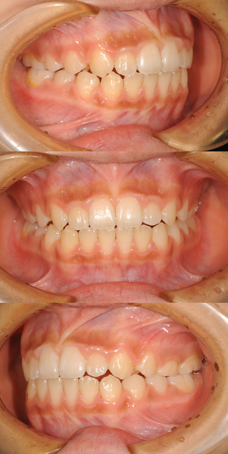 case_ortho-03a