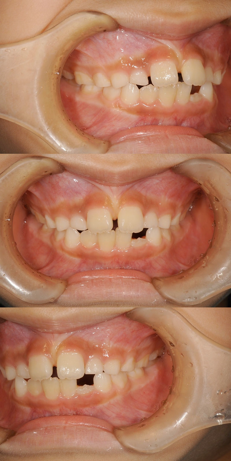 case_ortho-03b