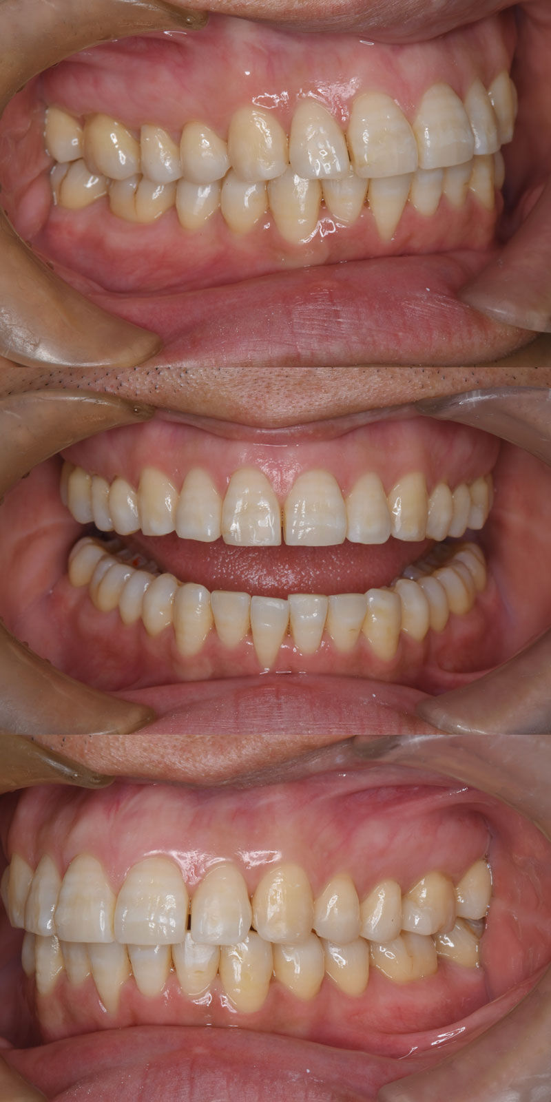 case_ortho-04a