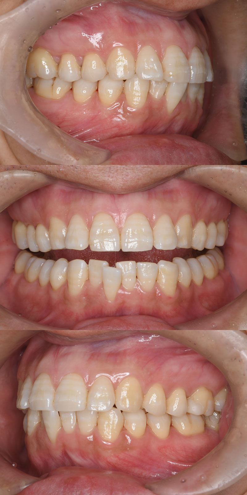 case_ortho-04b