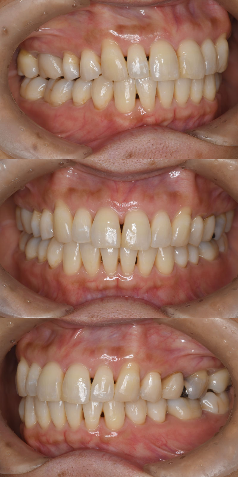 case_ortho-05a