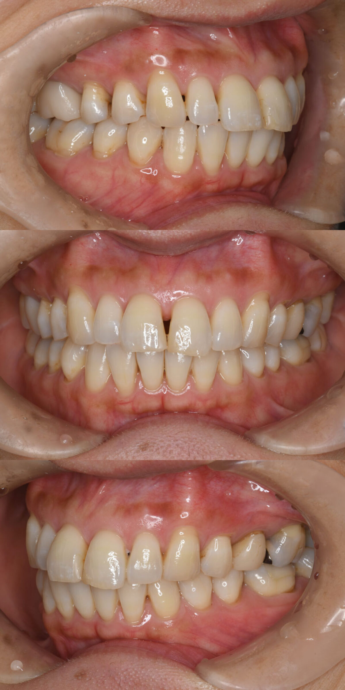 【ma-♪さん　専用】アライナー矯正歯科 アライナー矯正歯科治療 | Sandra Tai, 五十嵐 一, 森本 太一朗, 長尾