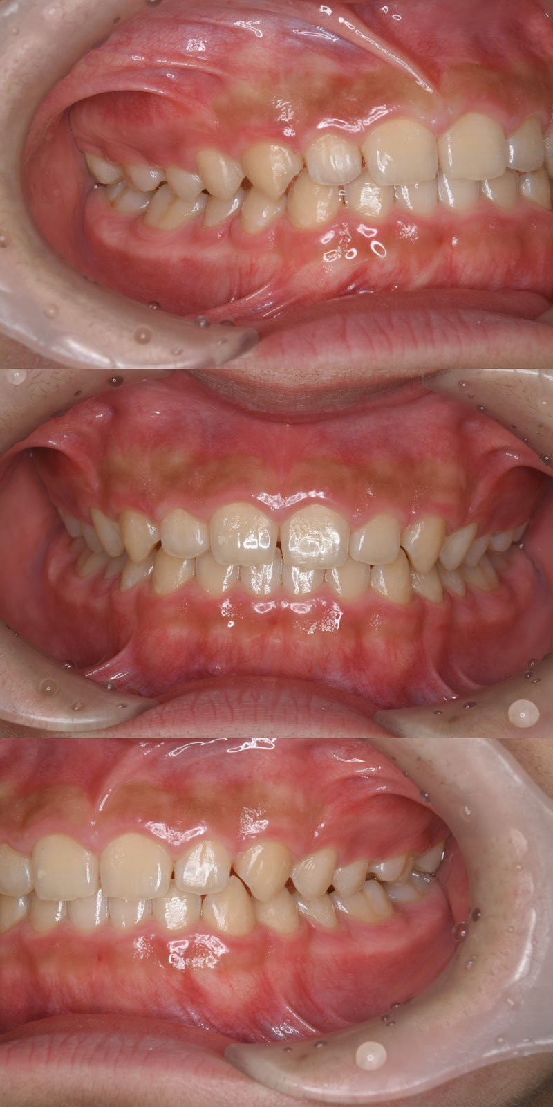 case_ortho-06a