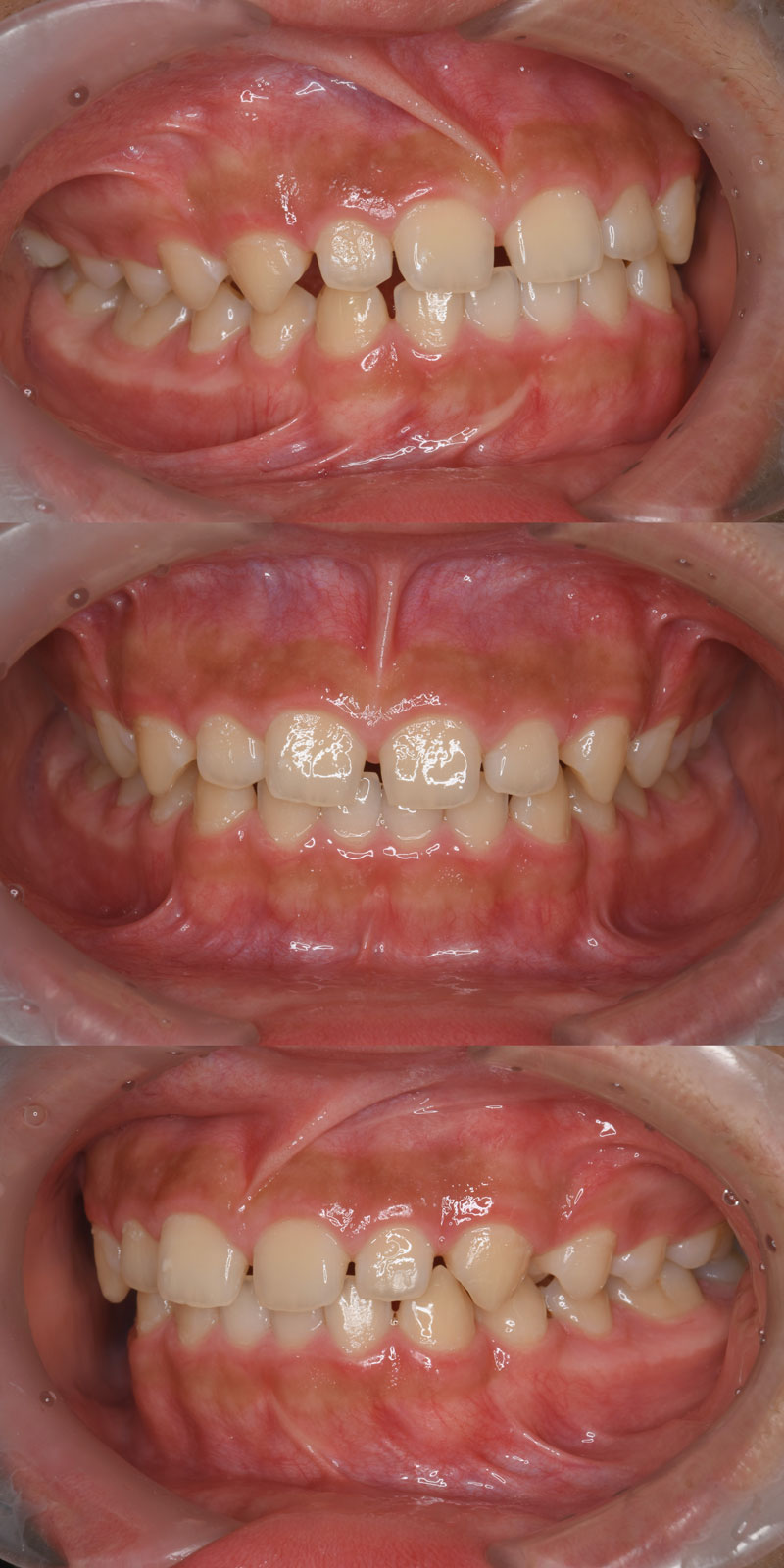 case_ortho-06b