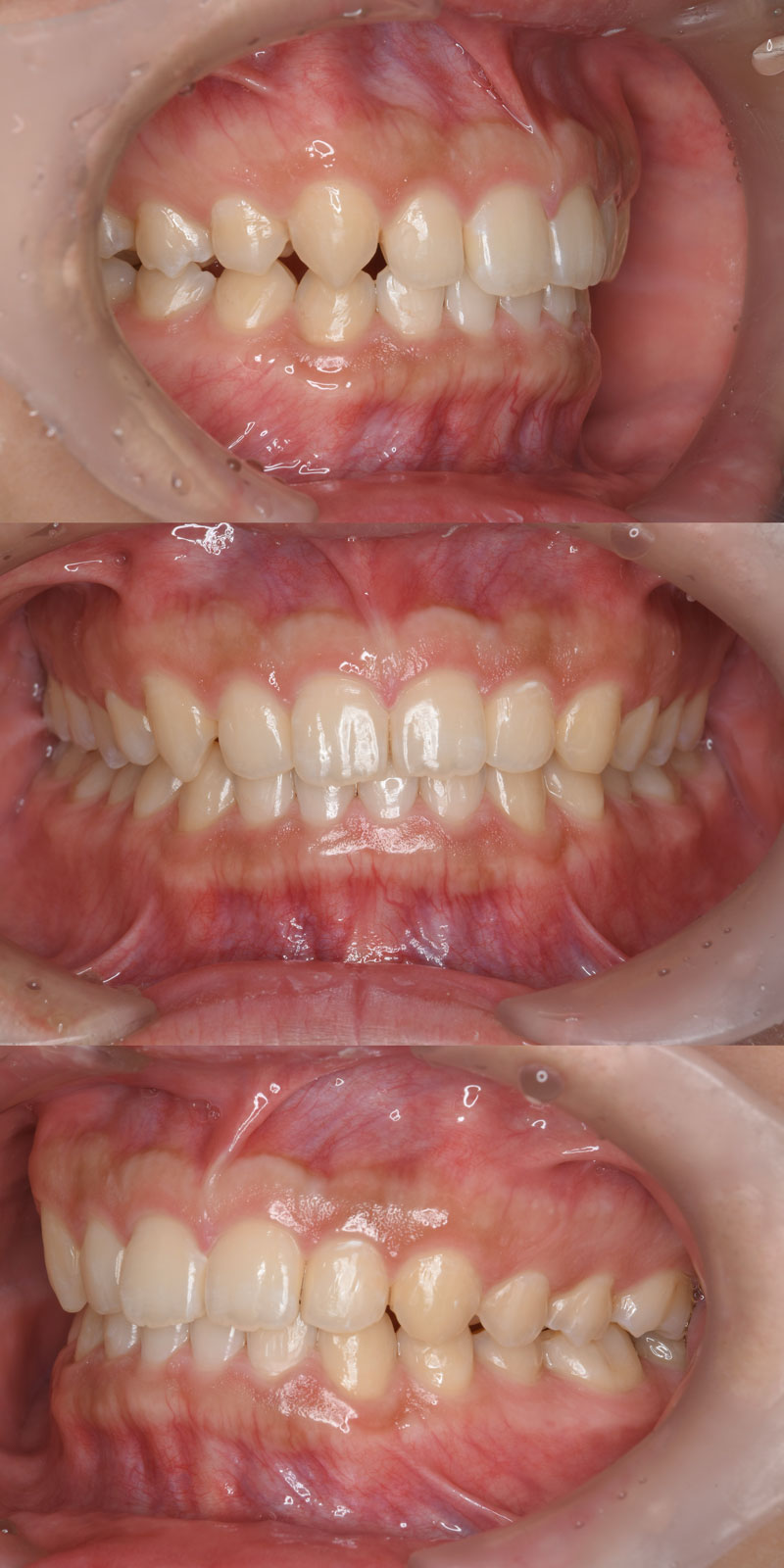 case_ortho-07a