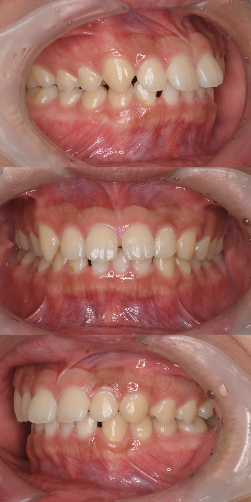 case_ortho-07b