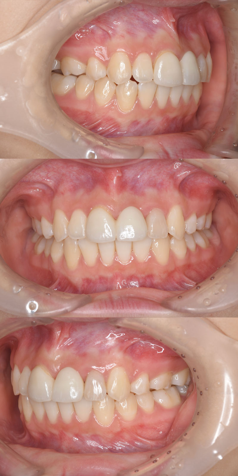 case_ortho-08a