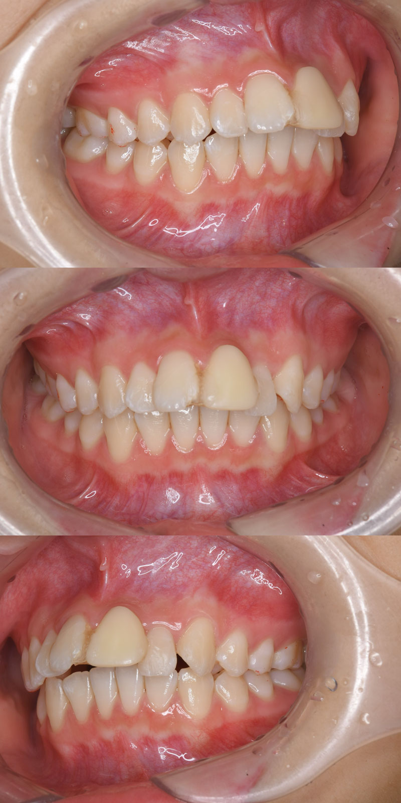 case_ortho-08b