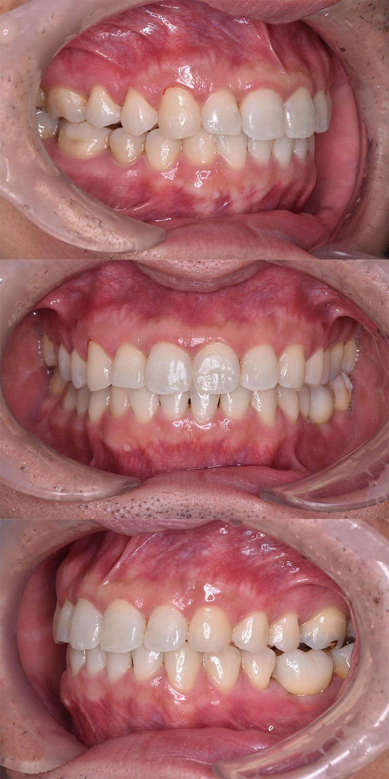 case_ortho-09a