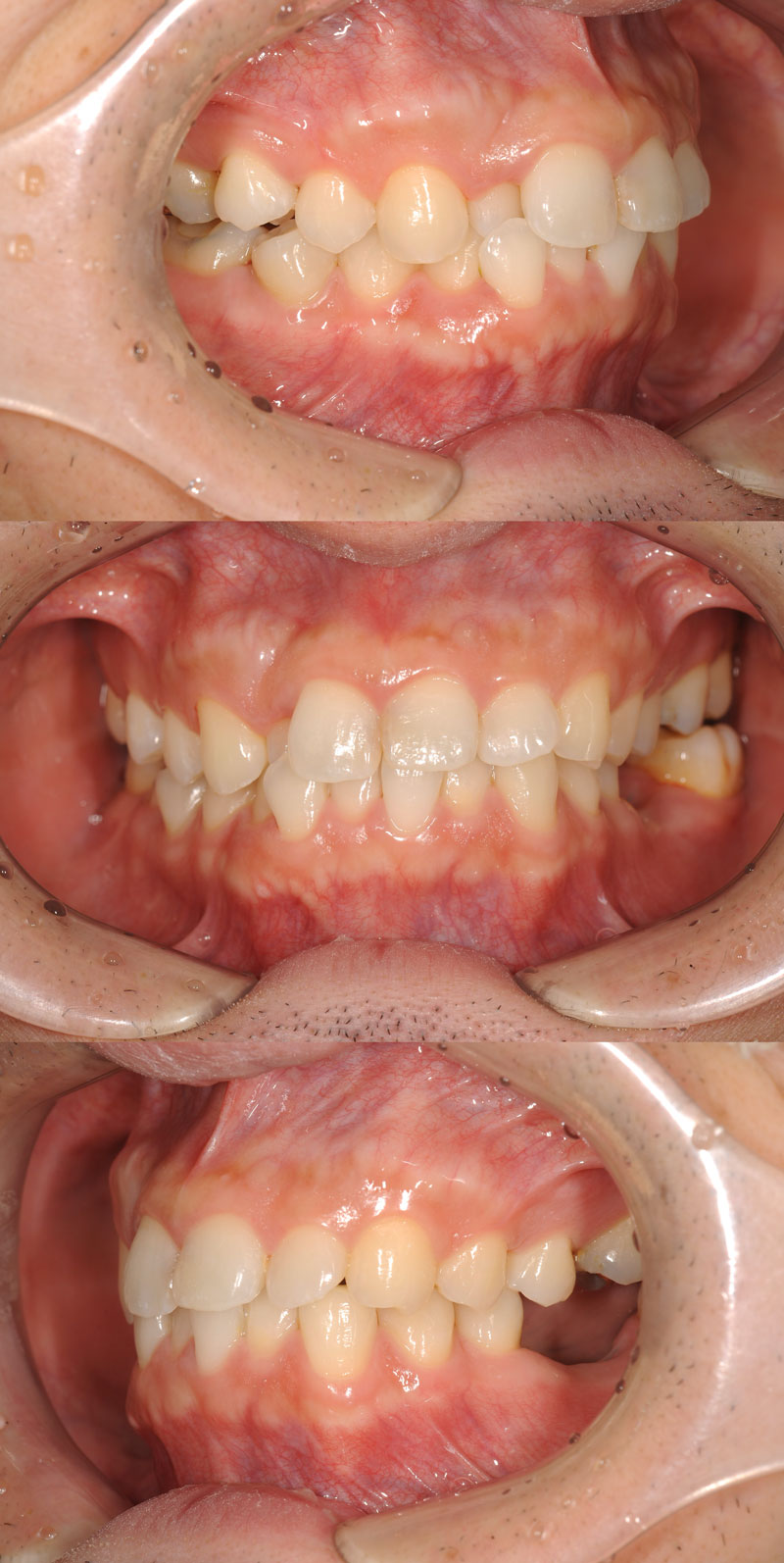 case_ortho-09b