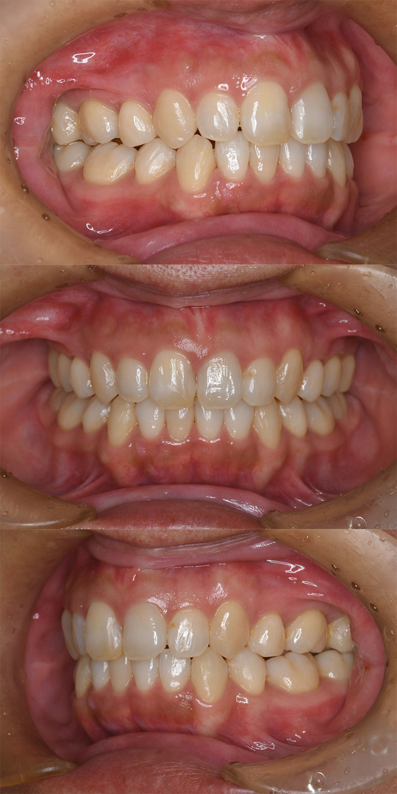 case_ortho-10a