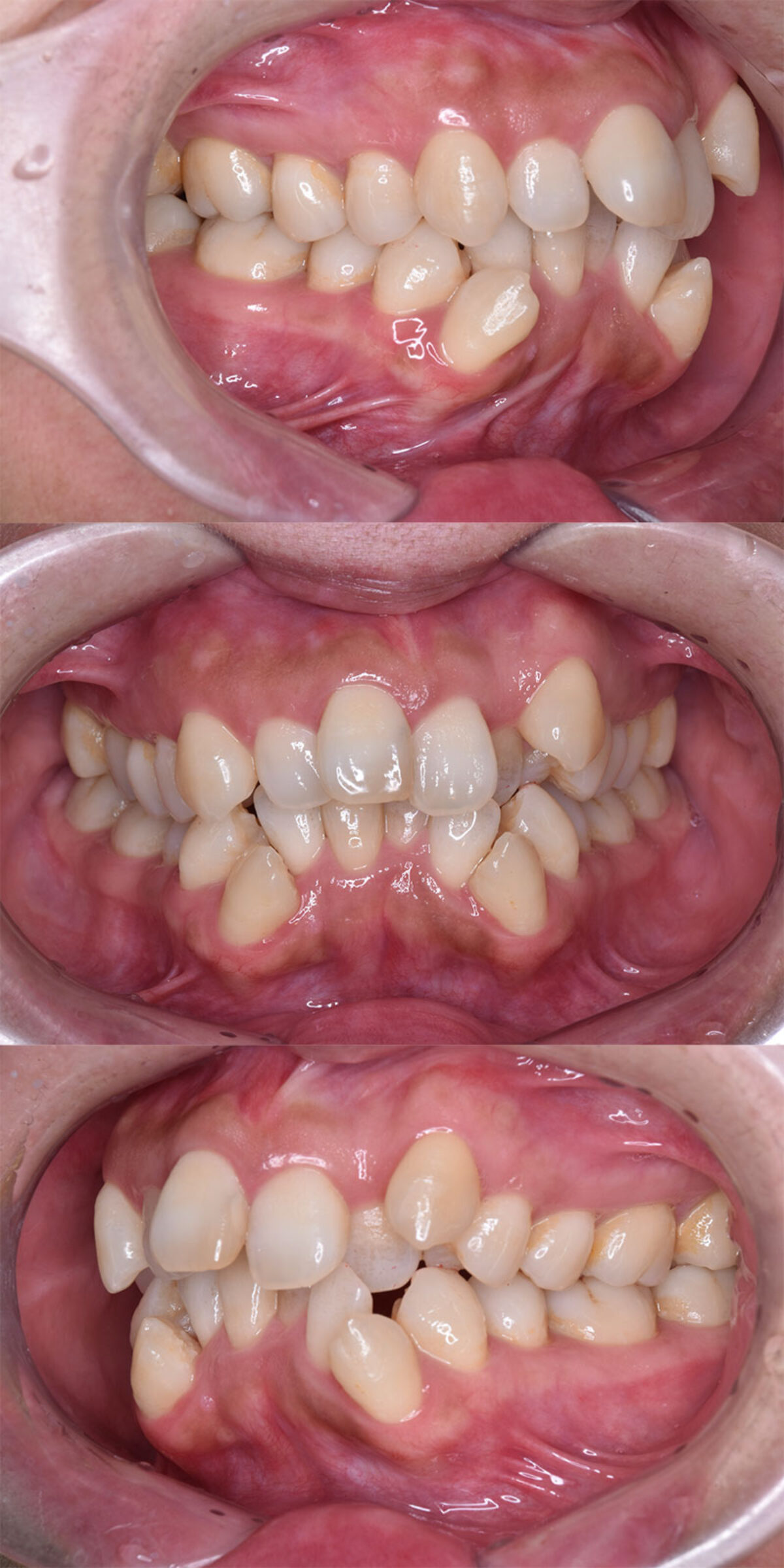 case_ortho-10b-1200x2400.jpg