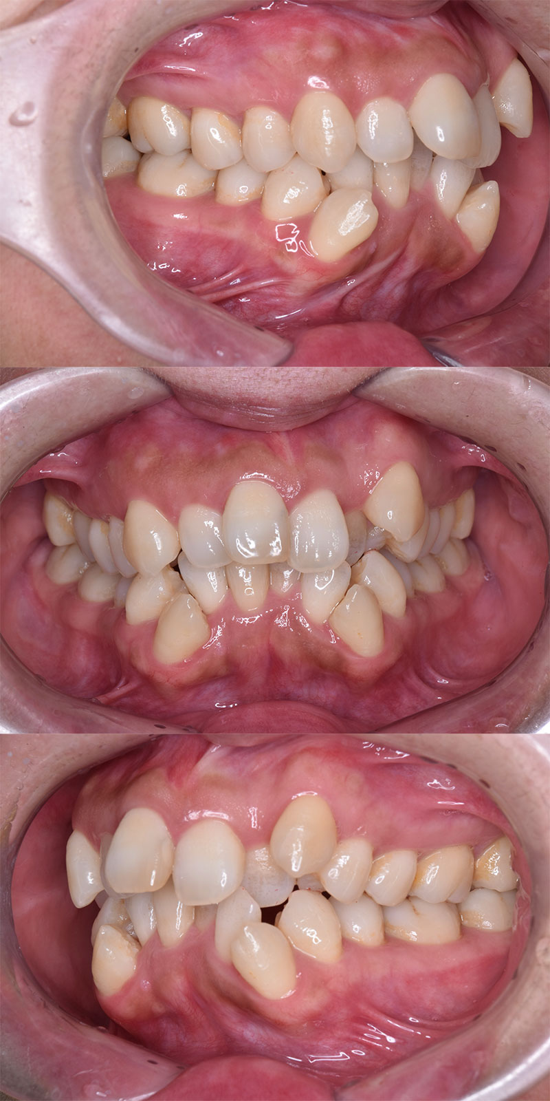 case_ortho-10b