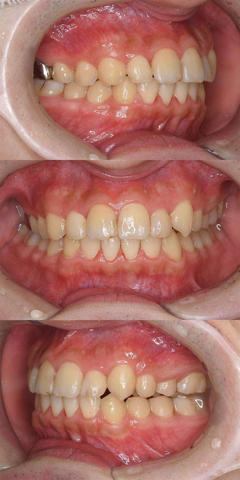 case_ortho-11a