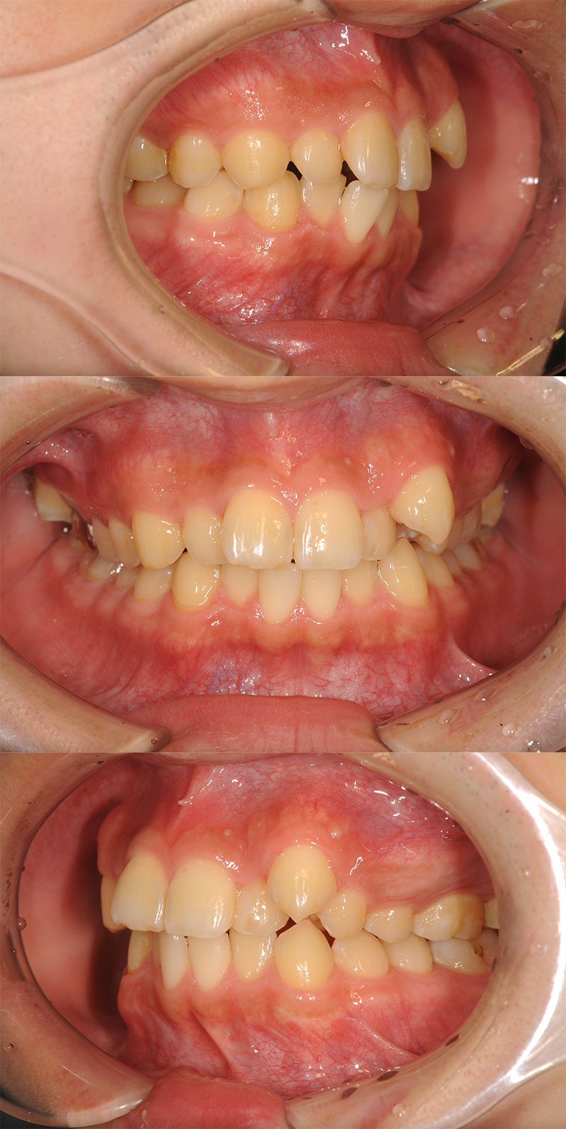 case_ortho-11b