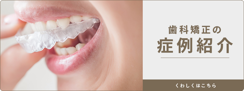 MAEDA DENTAL CLINIC　歯科矯正の症例紹介