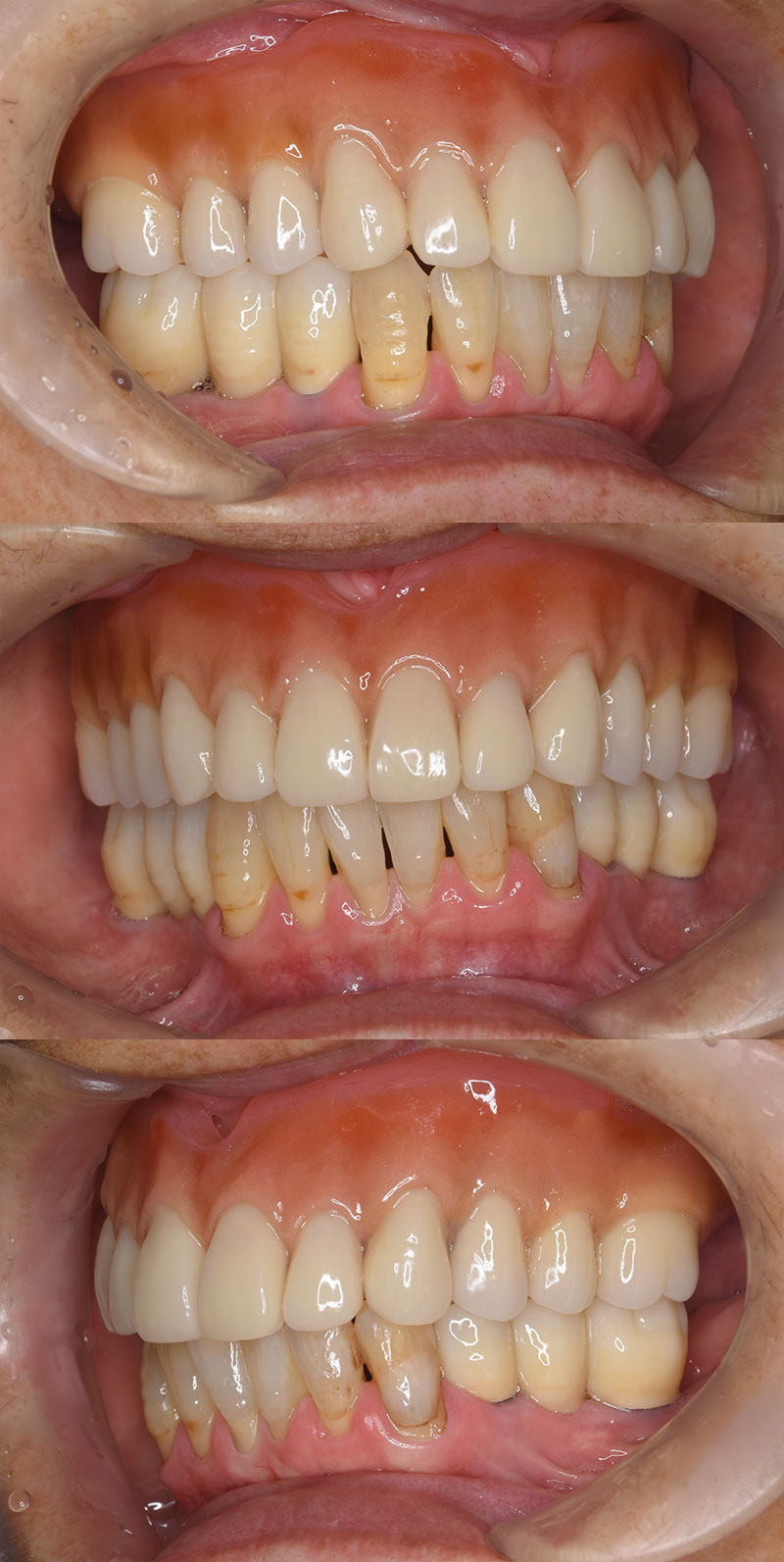 case_implant-01a