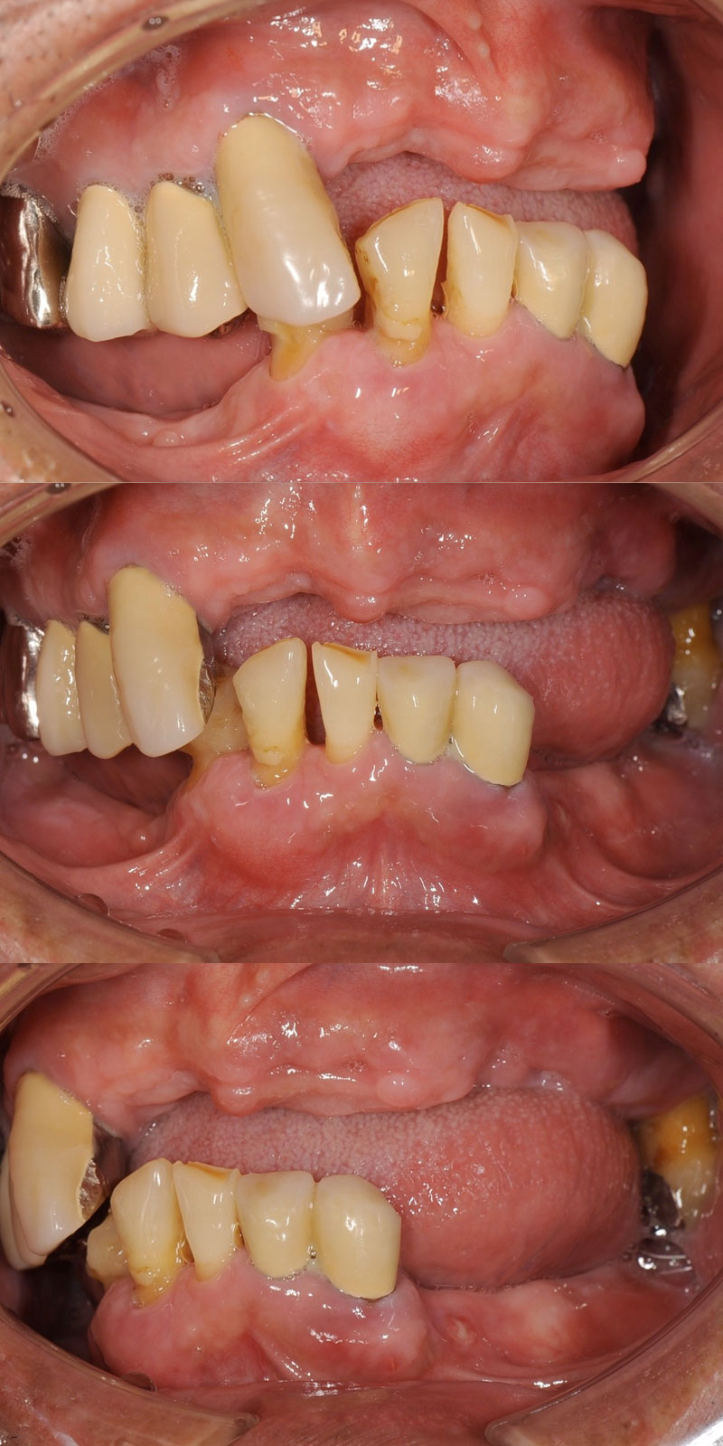case_implant-03b