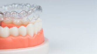 インビザラインの治療中の歯の様子