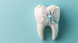 セラミック歯が寿命を迎えたイメージ