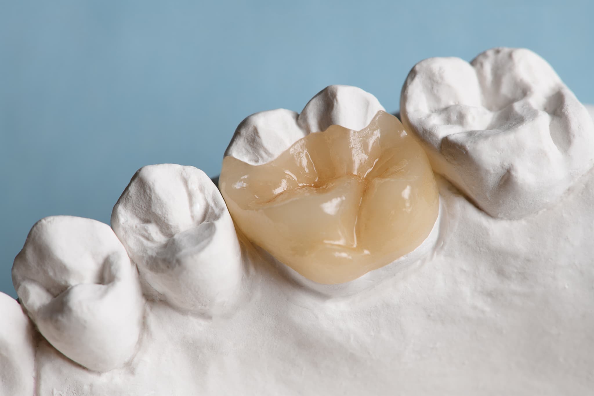 セラミックの歯のイメージ