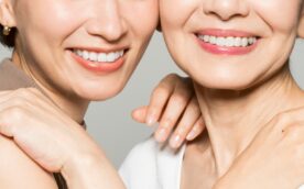 インプラント治療をした高齢女性と中年女性の口もとのイメージ