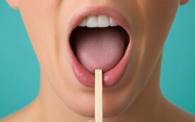 MFT（口腔筋機能療法）でスティックを使って正しい舌の位置をトレーニングしているイメージ