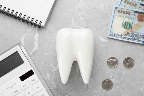 前歯をセラミックにするのにかかる費用のイメージ